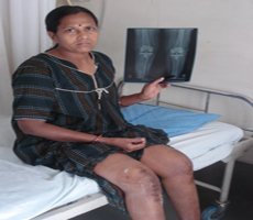 Slider image (8) Dr. S. V. Santpure | Consultant Joint Replacement Surgeon